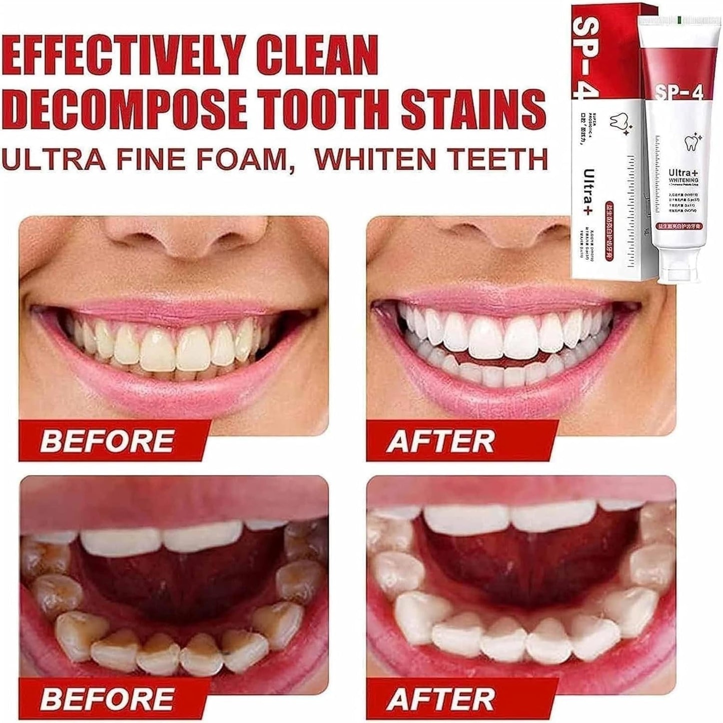 Yayashi Sp 4 Ultra Whitening Toothpaste Strong Stain Removal Fresh Breath Daily Oral Care - 120g,